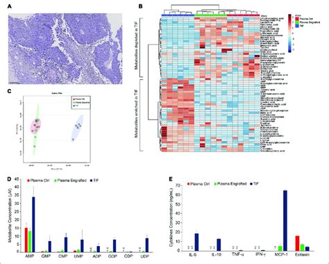 Characterization Of Melanoma Tumor Interstitial Fluid A