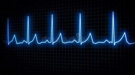 Electrocardiogram Visualization Stock Illustrations 229