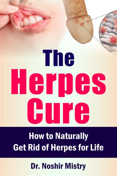 The Herpes Cure How To Naturally Get Rid Of Herpes For Life By Dr Noshir Mistry Goodreads