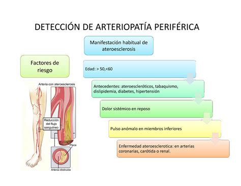 Detección DE Arteriopatía Periférica DETECCIÓN DE ARTERIOPATÍA