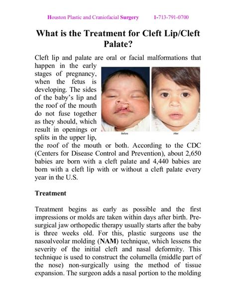 What is the Treatment for Cleft Lip/Cleft Palate?