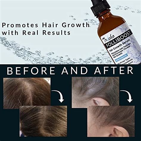 Tricho Labs Folliboost Hair Growth Serum Natural Based Formula With