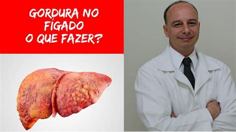 Gordura No F Gado Como Eliminar E Prevenir Dr Moacir Rosa Youtube