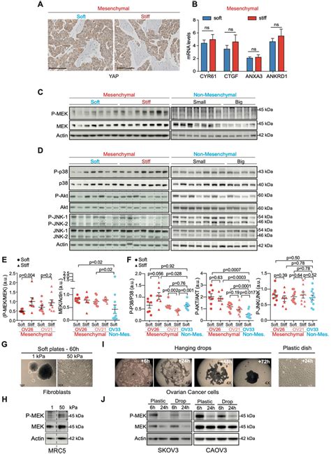 MEK Is Activated Upon Tumor Stiffening Of Mesenchymal HGSOC A