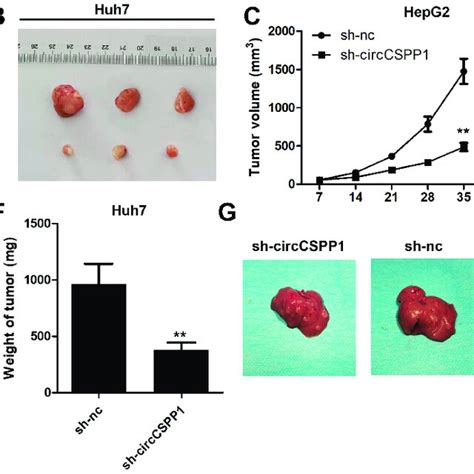 Knockdown Of Circcspp1 Inhibits The Proliferation Of Liver Cancer