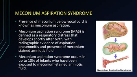 MECONIUM STAINED AMNIOTIC FLUID