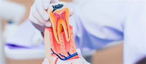 Endodoncia Odontodom