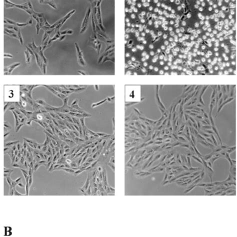 Bafilomycin A Inhibits The Cytotoxic Effects Of Iota Toxin On Vero