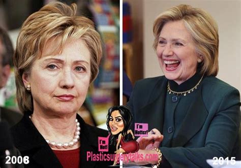 Hillary Clinton Plastic Surgery Facelift Properly Done Plastic Surgery Talks