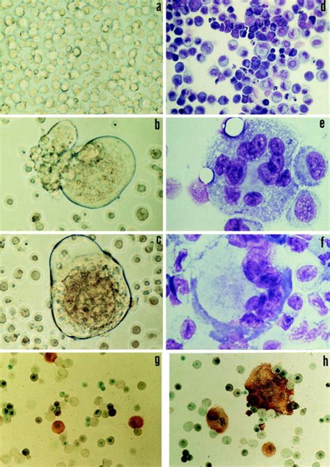 Mv Infection Induces Syncytia In Cultured Dc And Skin Lc Dc Derived Download Scientific