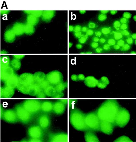 Translocation Of Pkc After Infection With L Monocyto Genes Or