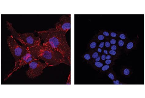 N Cadherin D4R1H XP Rabbit MAb Alexa Fluor 647 Conjugate Cell