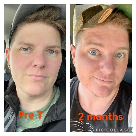 Pre T Vs 2 Months Of T Never Realized How Feminine I Looked Before R Ftm Selfies