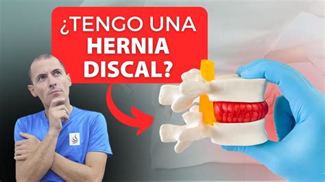 Cómo saber si tienes una hernia de disco YouTube