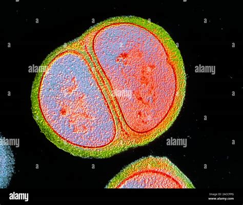 False Colour Transmission Electron Micrograph Tem Of A Single