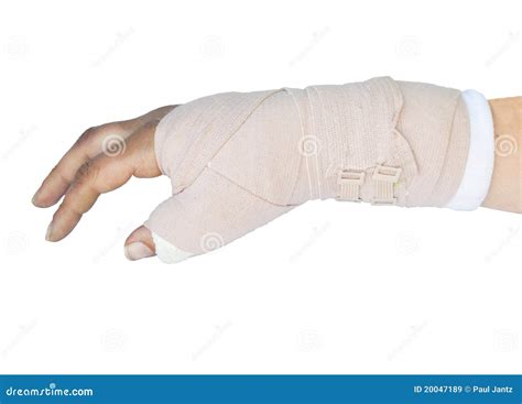 Broken Wrist In A Cast Royalty Free Stock Images - Image: 20047189