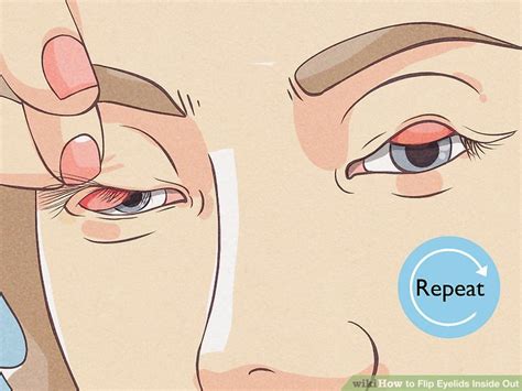 3 Ways To Flip Eyelids Inside Out WikiHow