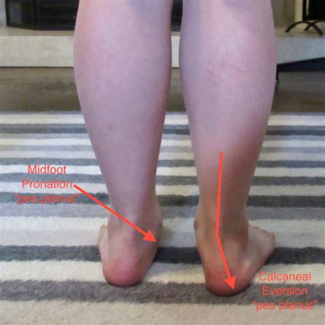 Are Flat Feet Happy Feet? — Boost Babies, LLC