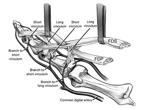 Tendon Diagram / Extensor Muscle Anatomy Britannica : Tendon hand tendons hands feet pinterest ...