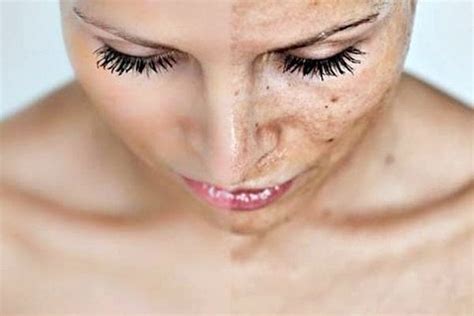 Peeling à Lacide Glycolique Quels Bienfaits Pour Le Visage