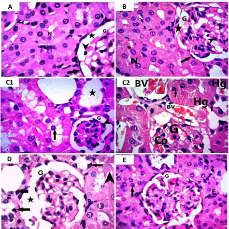 A Photomicrograph Of Mallory Trichrome Stained Sections Of Rat Renal