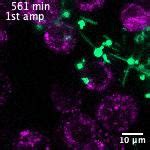 Figures And Data In Dynamic Persistence Of Upec Intracellular Bacterial