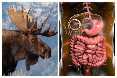 Hunters Sick With Rare Parasitic Tapeworm After Butchering Moose With ...