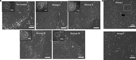 Kind Human Embryonic Stem Cells Hesc Retain In Vitro Pluripotency