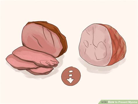 Ways To Prevent Myoma Wikihow Health