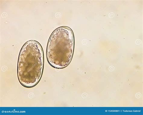 Strongyle Eggs Under The Microscope Uncinariaancylostoma Hookworm