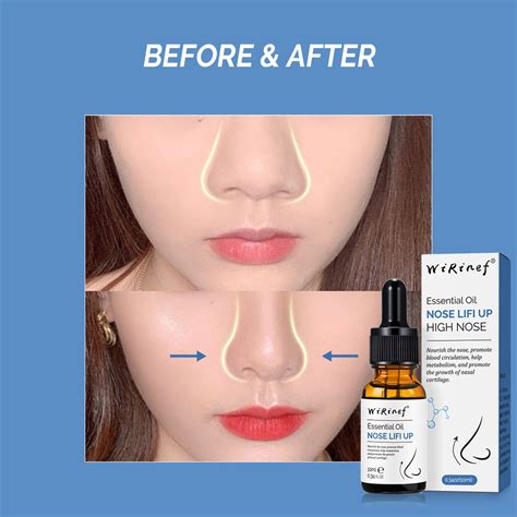 Nose Lift Up Essential Oil Nose Up Oil Nose Up Serum Nose Up Shaper