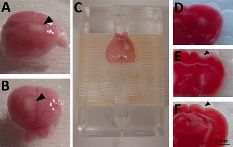 Photothrombotic Ischemia A Minimally Invasive And Reproducible