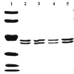 Sds Page Of Purified Wild Type And Mutant Enzymes Wild Type Lane