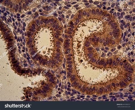 Photomicrograph Crosssection Human Endometrial Tissue Showing Stock