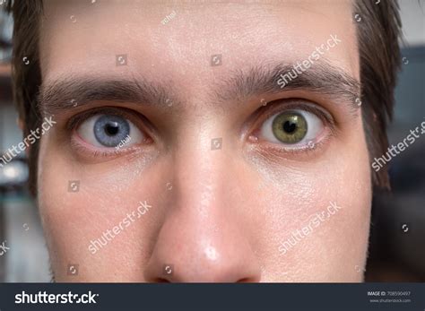 Humans With Two Different Eye Colors