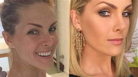 Ana Hickmann Aparece Sem Maquiagem E Fãs Criticam Sobrancelha