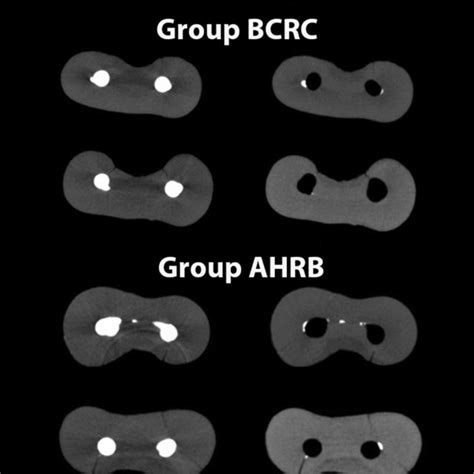 Representative Micro CT Cross Section Images Of The Mandibular Mesial