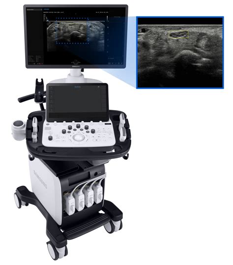 Samsung Introduces New Premium Ultrasound System V Samsung Global