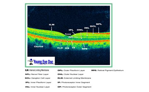 What Am I looking At Series: Part 1- Interpreting Macular OCT ...