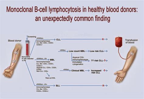 Medical Laboratory and Biomedical Science: Monoclonal B-cell ...