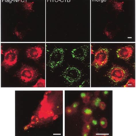 Expression Of Mutant NPC1 Proteins In NPC1 Cells Cells Were