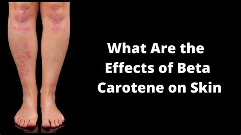 What Are the Effects of Beta Carotene on Skin - YouTube