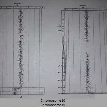 Molecular cytogenetic (array CGH) findings in the index case: (A) array ...