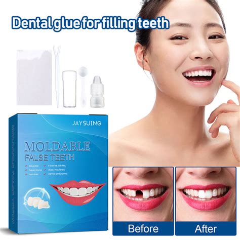 Temporary Tooth Repair Kit False Teeth Solid Glue Denture Missing Broken Teeth Shapeable Gutta