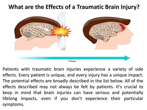 Ppt Boorgula Meher Thej What Are The Effects Of A Traumatic Brain