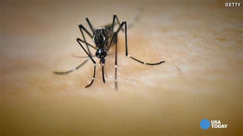 Sexually Transmitted Zika Virus Reported In Texas