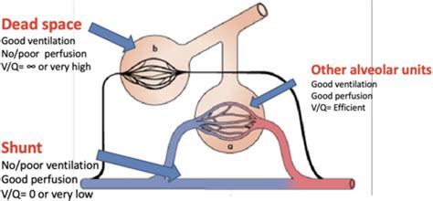 8 Matching Lung Ventilation To Lung Perfusion Flashcards Quizlet