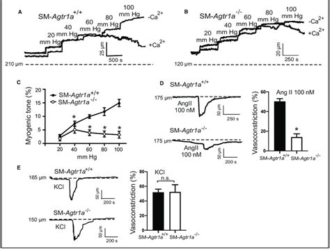 Myogenic Tone In Mesenteric Arteries A And B Representative