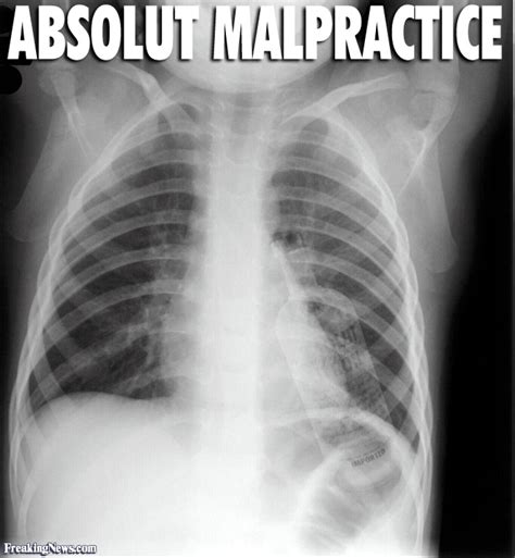 X Ray Quotes Quotesgram