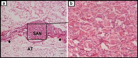 SA Node Histology